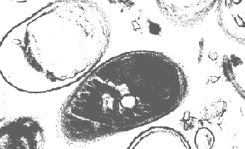 Encephalitozoon intestinalis